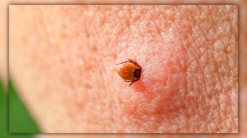 Can Bed Bugs Go in Your Private Parts? Facts & Myths Unveiled