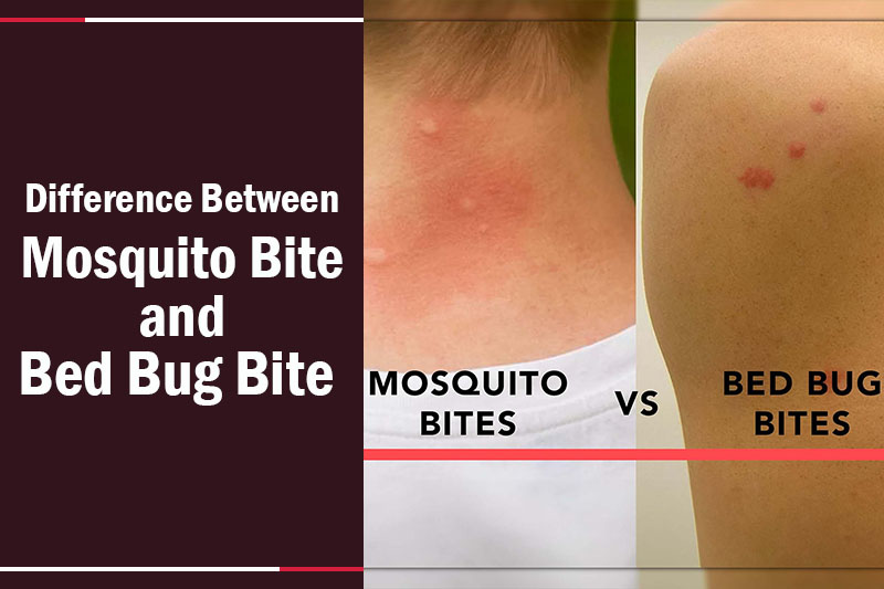 Difference Between Mosquito Bite and Bed Bug Bite 