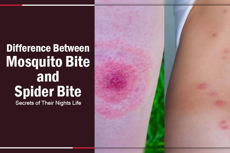 Difference Between Mosquito Bite and Spider Bite