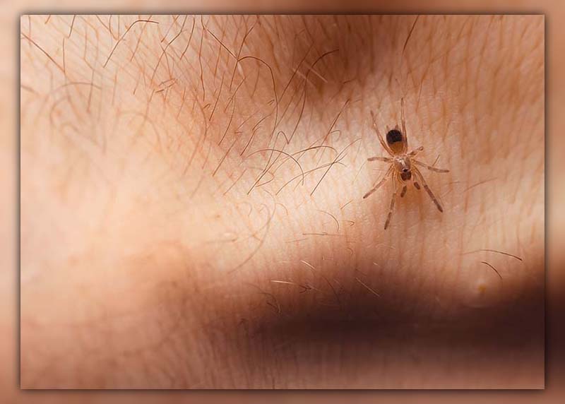 Difference Between Mosquito Bite and Spider Bite