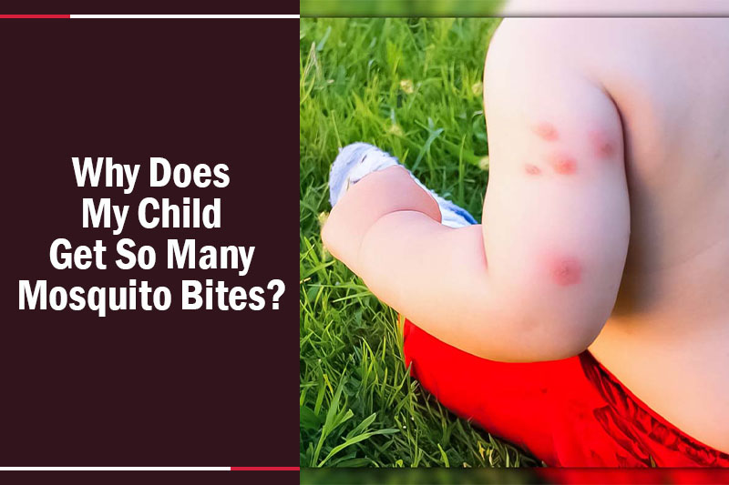 Why Does My Child Get So Many Mosquito Bites 