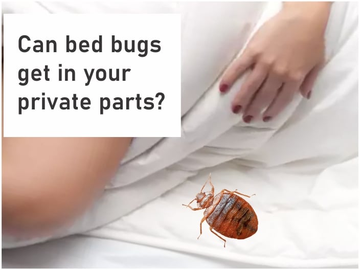 Can Bed Bugs Get In Your Private Parts, How To Keep Bed Bugs From Biting You